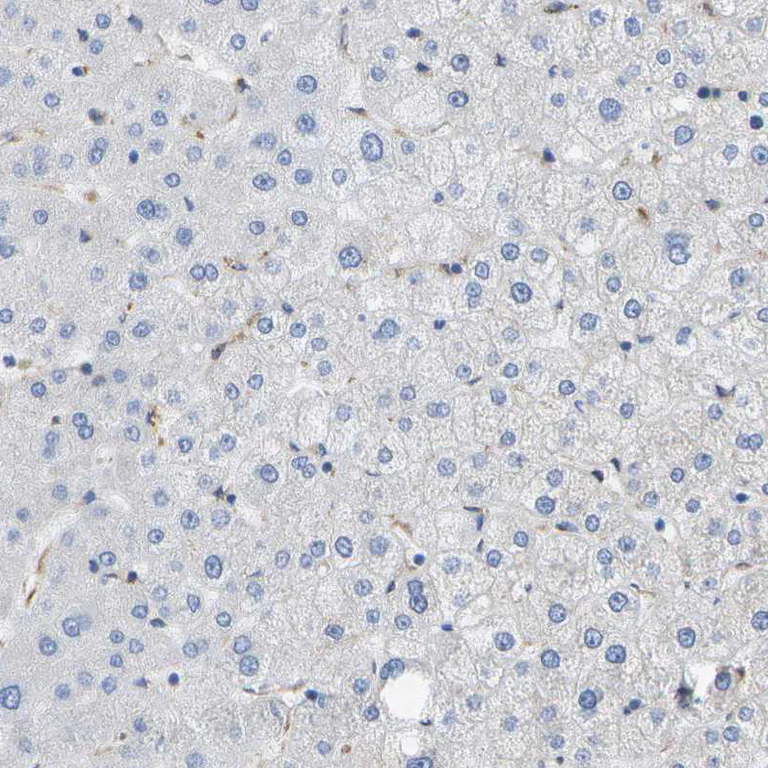 Immunohistochemistry (Formalin/PFA-fixed paraffin-embedded sections) - Anti-HIP14 antibody (AB253017)