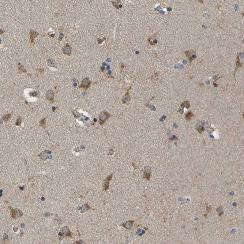 Immunohistochemistry (Formalin/PFA-fixed paraffin-embedded sections) - Anti-HIP14 antibody (AB253017)