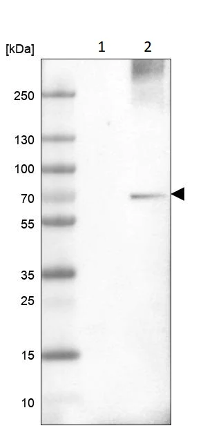 Western blot - Anti-HIP14 antibody (AB253017)