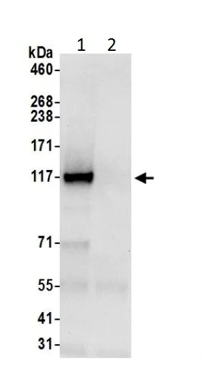 Immunoprecipitation - Anti-HIP1R antibody (AB226197)