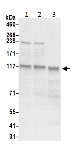 Western blot - Anti-HIP1R antibody (AB226197)