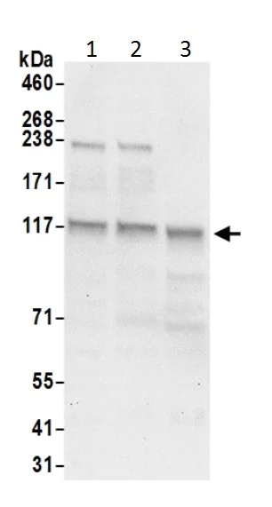 Western blot - Anti-HIP1R antibody (AB226197)
