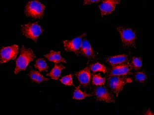 Immunocytochemistry/ Immunofluorescence - Anti-HIP1R antibody [EPR9437] (AB140608)