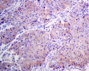 Immunohistochemistry (Formalin/PFA-fixed paraffin-embedded sections) - Anti-HIP1R antibody [EPR9437] (AB140608)