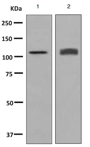 Western blot - Anti-HIP1R antibody [EPR9437] (AB140608)