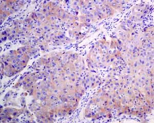 Immunohistochemistry (Formalin/PFA-fixed paraffin-embedded sections) - Anti-HIP1R antibody [EPR9437] - BSA and Azide free (AB248899)