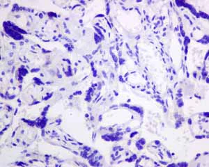 Immunohistochemistry (Formalin/PFA-fixed paraffin-embedded sections) - Anti-HIP1R antibody [EPR9437] - BSA and Azide free (AB248899)