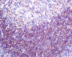 Immunohistochemistry (Formalin/PFA-fixed paraffin-embedded sections) - Anti-HIP1R antibody [EPR9437] - BSA and Azide free (AB248899)