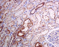 Immunohistochemistry (Formalin/PFA-fixed paraffin-embedded sections) - Anti-HIP1R antibody [EPR9437] - BSA and Azide free (AB248899)