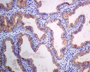 Immunohistochemistry (Formalin/PFA-fixed paraffin-embedded sections) - Anti-HIP1R antibody [EPR9437] - BSA and Azide free (AB248899)