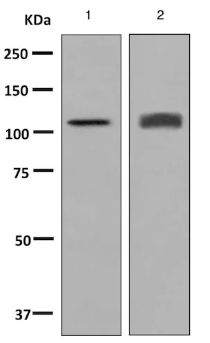 Western blot - Anti-HIP1R antibody [EPR9437] - BSA and Azide free (AB248899)