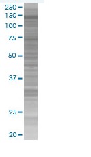 HIP1R overexpression 293T lysate (whole cell)