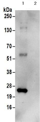 Immunoprecipitation - Anti-HIP2/LIG antibody - C-terminal (AB177521), expandable thumbnail