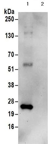 Immunoprecipitation - Anti-HIP2/LIG antibody - C-terminal (AB177521)