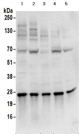 Western blot - Anti-HIP2/LIG antibody - C-terminal (AB177521), expandable thumbnail