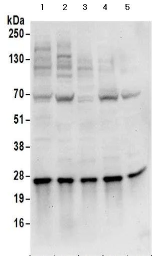 Western blot - Anti-HIP2/LIG antibody - C-terminal (AB177521)