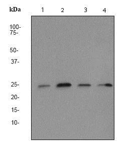 Western blot - Anti-HIP2/LIG antibody [EP1144Y] - BSA and Azide free (AB247369)