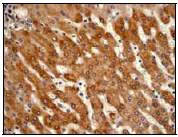Immunohistochemistry (Formalin/PFA-fixed paraffin-embedded sections) - Anti-HIP2/LIG antibody [EP1145Y] (AB52930)