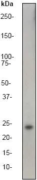 Western blot - Anti-HIP2/LIG antibody [EP1145Y] (AB52930)