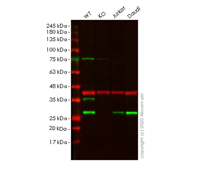 Western blot - Anti-HIP2/LIG antibody [EP1145Y] - BSA and Azide free (AB247338)