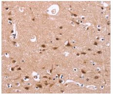 Immunohistochemistry (Formalin/PFA-fixed paraffin-embedded sections) - Anti-HIPK1 antibody (AB198802)