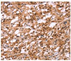 Immunohistochemistry (Formalin/PFA-fixed paraffin-embedded sections) - Anti-HIPK1 antibody (AB198802)