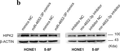 Western blot - Anti-HIPK2 antibody [EPR3819] (AB108543), expandable thumbnail
