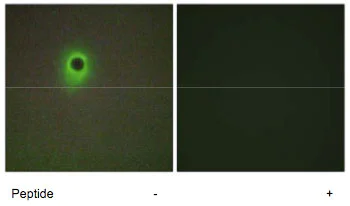 Immunocytochemistry/ Immunofluorescence - Anti-HIPK4 antibody (AB69565)