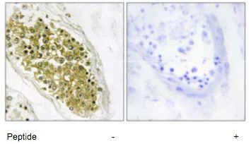 Immunohistochemistry (Formalin/PFA-fixed paraffin-embedded sections) - Anti-HIPK4 antibody (AB69565)