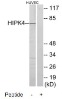 Western blot - Anti-HIPK4 antibody (AB69565)