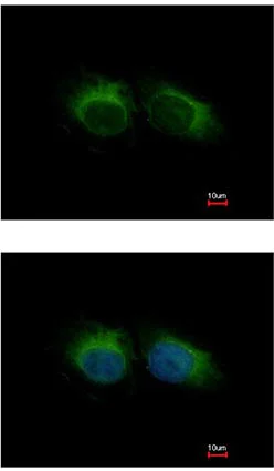 Immunocytochemistry/ Immunofluorescence - Anti-HIPPI/IFT57 antibody (AB154601)