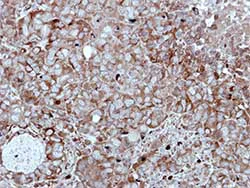 Immunohistochemistry (Formalin/PFA-fixed paraffin-embedded sections) - Anti-HIPPI/IFT57 antibody (AB154601)