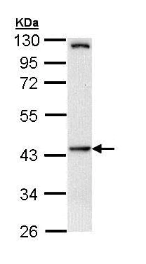 Western blot - Anti-HIPPI/IFT57 antibody (AB154601)