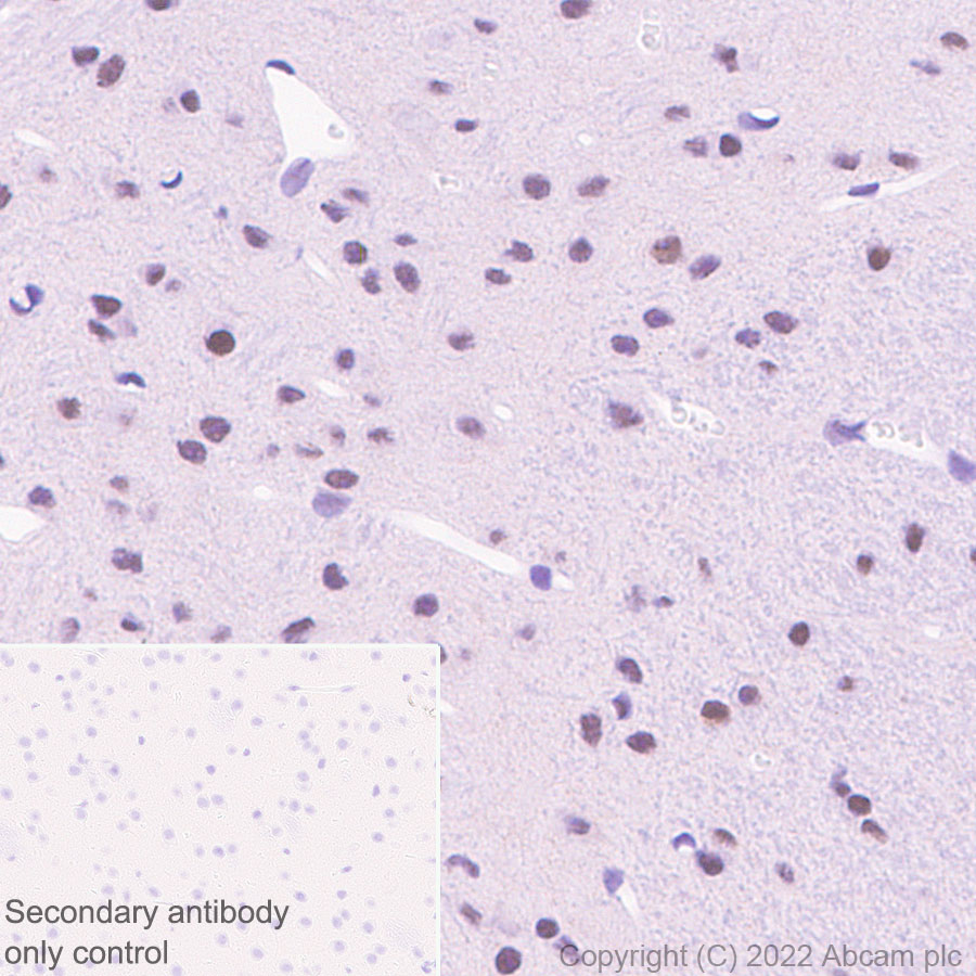 Immunohistochemistry - Anti-HIRA/HIR antibody [EPR25299-11] - BSA and Azide free (AB302929), expandable thumbnail