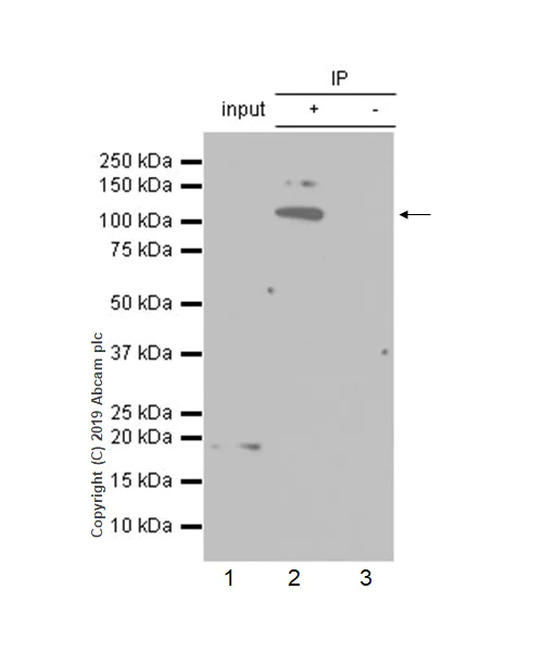 Immunoprecipitation - Anti-HIRA/HIR antibody [EPR7416] - BSA and Azide free (AB232477)