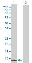 Western blot - Anti-Histatin 1 antibody (AB70024)