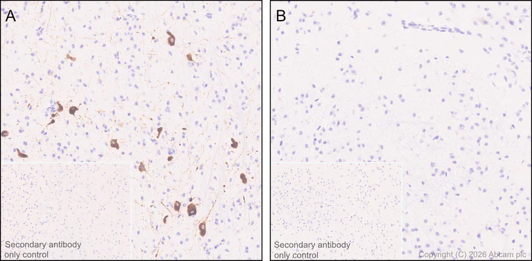 Immunohistochemistry (Formalin/PFA-fixed paraffin-embedded sections) - Anti-Histidine decarboxylase antibody [EPR26392-79] (AB315444)