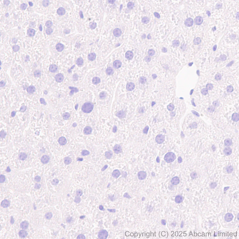 Immunohistochemistry (Formalin/PFA-fixed paraffin-embedded sections) - Anti-Histidine decarboxylase antibody [EPR26392-79] (AB315444)