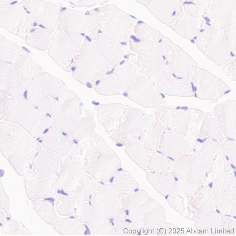 Immunohistochemistry (Formalin/PFA-fixed paraffin-embedded sections) - Anti-Histidine decarboxylase antibody [EPR26392-79] (AB315444)
