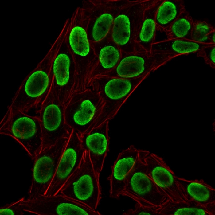 Immunocytochemistry - Anti-Histone H1 antibody [HH1/1784R] (AB218418), expandable thumbnail