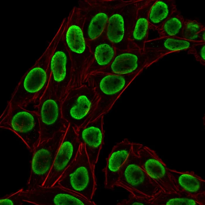 Immunocytochemistry - Anti-Histone H1 antibody [HH1/1784R] (AB218418)