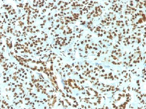 Immunohistochemistry (Formalin/PFA-fixed paraffin-embedded sections) - Anti-Histone H1 antibody [HH1/1784R] (AB218418), expandable thumbnail