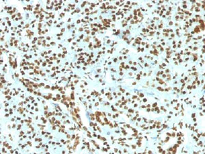 Immunohistochemistry (Formalin/PFA-fixed paraffin-embedded sections) - Anti-Histone H1 antibody [HH1/1784R] (AB218418)