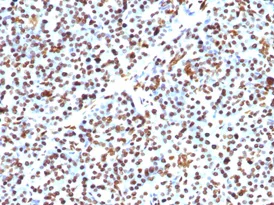 Immunohistochemistry (Formalin/PFA-fixed paraffin-embedded sections) - Anti-Histone H1 antibody [HH1/957] - BSA and Azide free (AB216609)