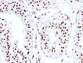 Immunohistochemistry (Formalin/PFA-fixed paraffin-embedded sections) - Anti-Histone H1 antibody [HH1/957] - BSA and Azide free (AB216609)