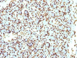Immunohistochemistry (Formalin/PFA-fixed paraffin-embedded sections) - Anti-Histone H1 antibody [r1415-1] (AB218417), expandable thumbnail