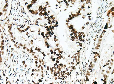 Immunohistochemistry (Formalin/PFA-fixed paraffin-embedded sections) - Anti-Histone H1.0 antibody [27] (AB11080)