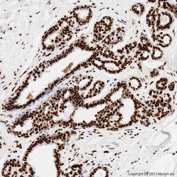 Immunohistochemistry (Formalin/PFA-fixed paraffin-embedded sections) - Anti-Histone H1.0 antibody [34] (AB11079), expandable thumbnail