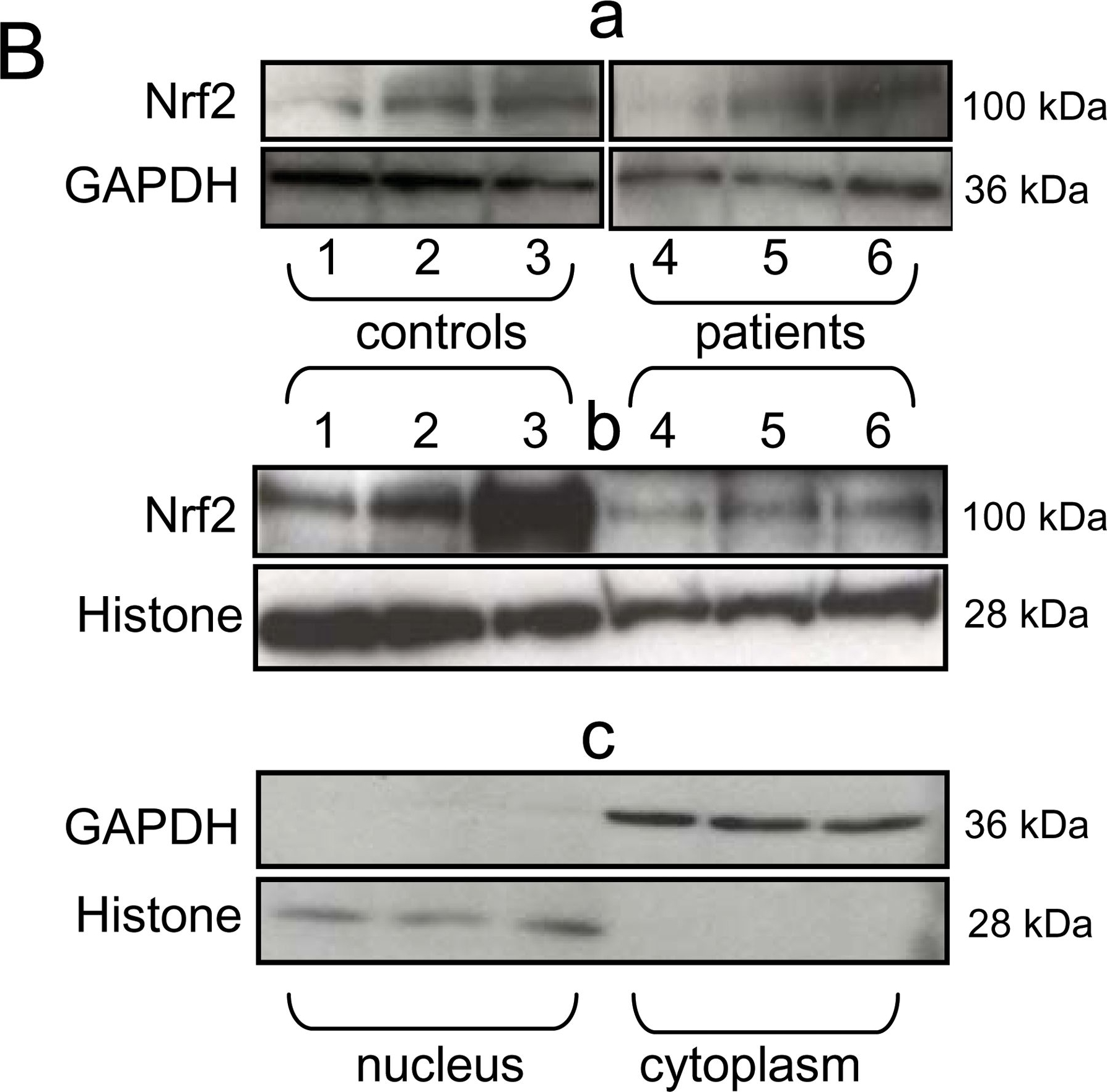 Western blot - Anti-Histone H1.0 antibody [34] (ab11079), expandable thumbnail