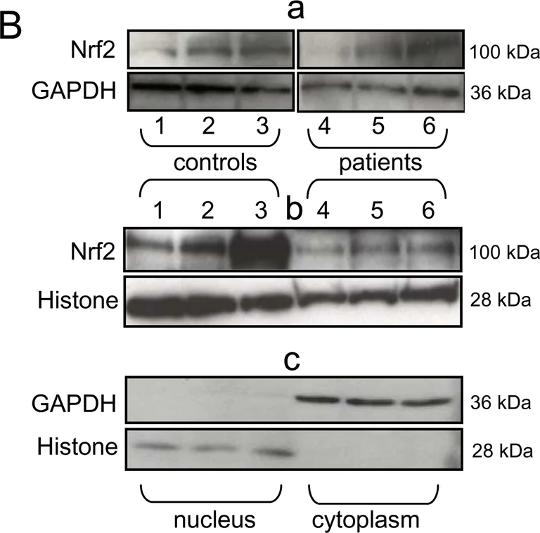 Western blot - Anti-Histone H1.0 antibody [34] (AB11079)